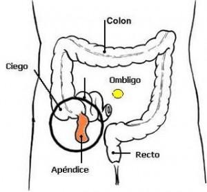 Síntomas de un apendicitis