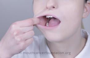 Sin cachetes por favor