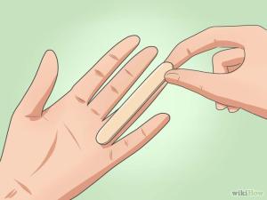 Dedo en gatillo Artricenter 5