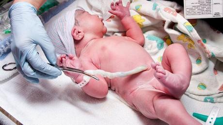 La cirugía de emergencia generalmente se lleva a cabo inmediatamente después del nacimiento