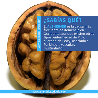 GUÍA No es Alzheimer... es Lewy