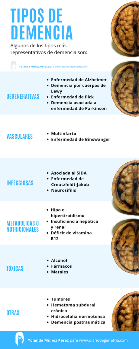 GUÍA No es Alzheimer... es Lewy