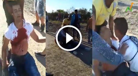 Asesinan a sangre fría con un tiro en el pecho a un joven en Cuba