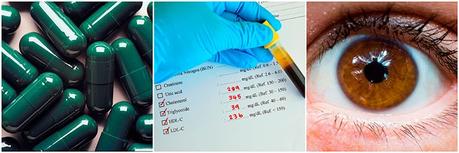 Efectos secundarios de la lisina