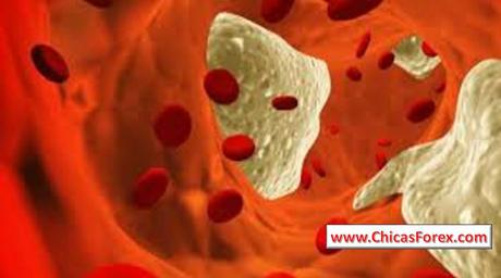 Hipercalcemia: sintomas, tratamentos e causas