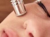 saber sobre microdermabrasión