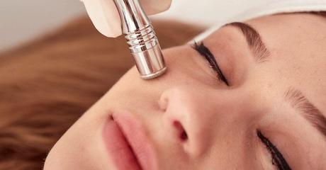 Qué saber sobre la microdermabrasión a microdermabrasión puede reducir los signos del envejecimiento