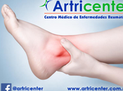 Artricenter: Artritis tobillo