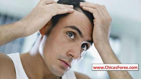 CAÍDA DEL CABELLO: MANIFESTACIÓN, CAUSAS Y PREVENCIÓN