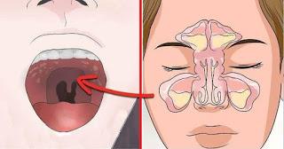Aliviar la congestión nasal