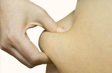 Estar saludable con sobrepeso. ¿Es posible? Estar saludable con sobrepeso. ¿Es posible?