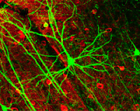 Identifican la Molécula Responsable del Aprendizaje y la Memoria