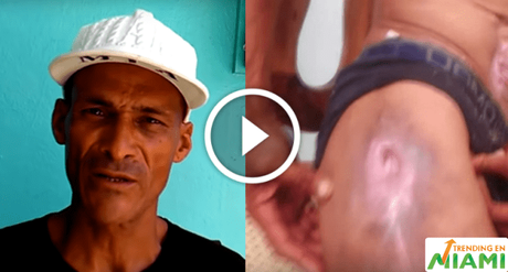 Ciudadanos cubanos son víctimas de golpizas y amenazas organizadas por el régimen