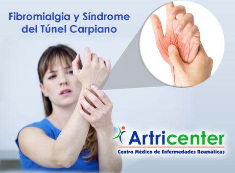 Artricenter: Fibromialgia y síndrome del túnel carpiano en pacientes con esta enfermedad. Artricenter: Fibromialgia y síndrome del túnel carpiano en pacientes con esta enfermedad.