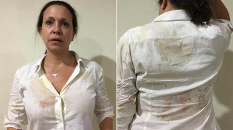 Denuncian que ataque contra María Corina Machado fue ordenado por el régimen cubano