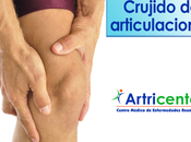 Artricenter: ¿Qué significa cuando crujen articulaciones?