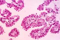 Una Proteína Cerebral Contrarresta las Alteraciones del Envejecimiento