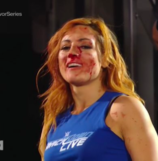 Becky lynch orgullosa de su sangre en RAW
