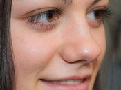 Cómo quitar ojeras, remedios caseros