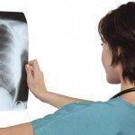 Calcificación: causas, síntomas, prevención y tratamiento de depósitos de calcio Dra. Lizbeth
