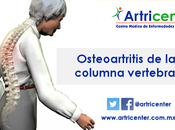 Artricenter: Osteoartrosis columna vertebral