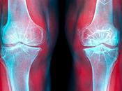 Dolor articulaciones tratamiento natural