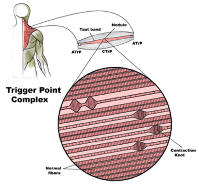 Relajantes Musculares – Debes saber esto antes de usarlos