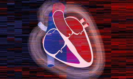 Miocardiopatía hipertrófica obstructiva: causas, síntomas y tratamiento