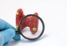 Tratamiento del hiperparatiroidismo primario Tratamiento del hiperparatiroidismo primario