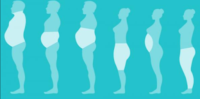 tipos de obesidad tipos de obesidades