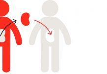 Trasplante de riñón: visión general y tasa de éxito