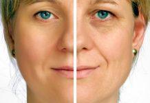 6 razones por las que puede tener arrugas prematuras y qué puede hacer al respecto