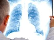 enfermedad pulmonar puede aumentar riesgo demencia