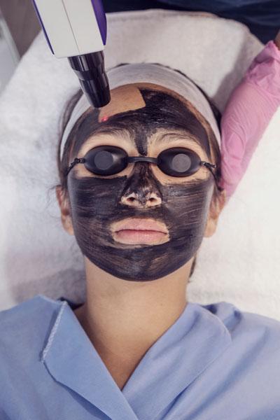 Tratamientos de belleza con láser