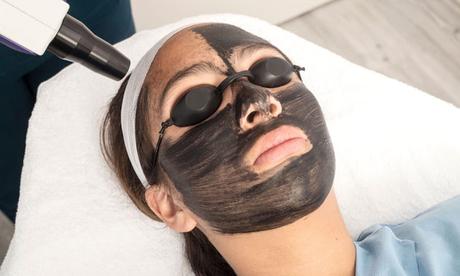 Tratamientos de belleza con láser