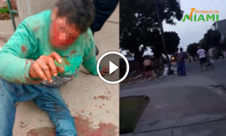 En Cienfuegos una familia le da una fuerte paliza al violador de una niña de 7 años En Cienfuegos una familia le da una fuerte paliza al violador de una niña de 7 años