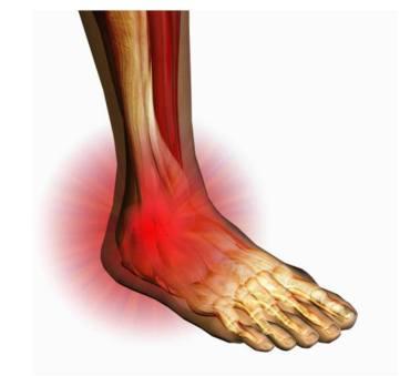 Artricenter: 4 tips para reducir el riesgo de problemas de tobillo en las enfermedades reumáticas. Artricenter: 4 tips para reducir el riesgo de problemas de tobillo en las enfermedades reumáticas.