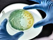 Color heces ¿qué puede significar?