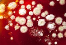 ¿Cómo tratar una infección por hongos en el pene?