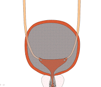 Desarrollan método no invasivo para detectar el cáncer de vejiga