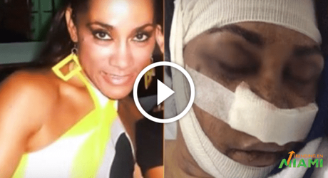 Joven cubana entre la vida y la muerte debido a una brutal golpiza que sufrió