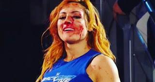 Becky lynch sigue con nariz rota y no se sabe si luchará en TLC