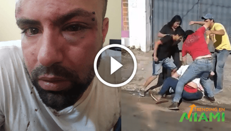 Joven cubano víctima de brutal golpiza y asegura que está amenazado de muerte