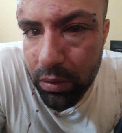 Joven cubano víctima de brutal golpiza y asegura que está amenazado de muerte Joven cubano víctima de brutal golpiza y asegura que está amenazado de muerte