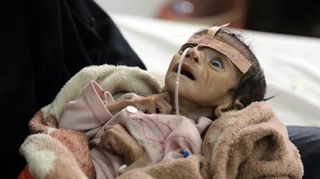 Multiverso interior I - Universo exterior(Yemen se muere) Multiverso interior I - Universo exterior(Yemen se muere)