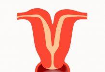 ¿Qué es un útero didelfo?