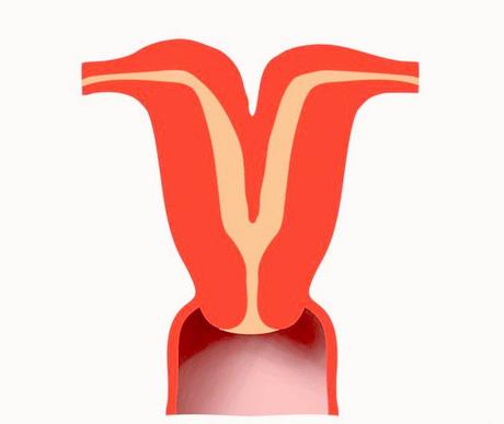 ¿Es posible un embarazo saludable con un útero desleal? ¿Qué es un útero didelfo?