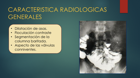 Enfermedades del Intestino delgado