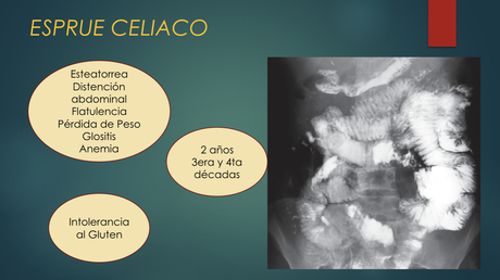 Enfermedades del Intestino delgado