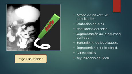 Enfermedades del Intestino delgado